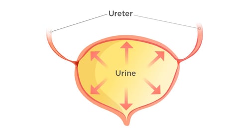 Atonic Bladder Blog illustration-1